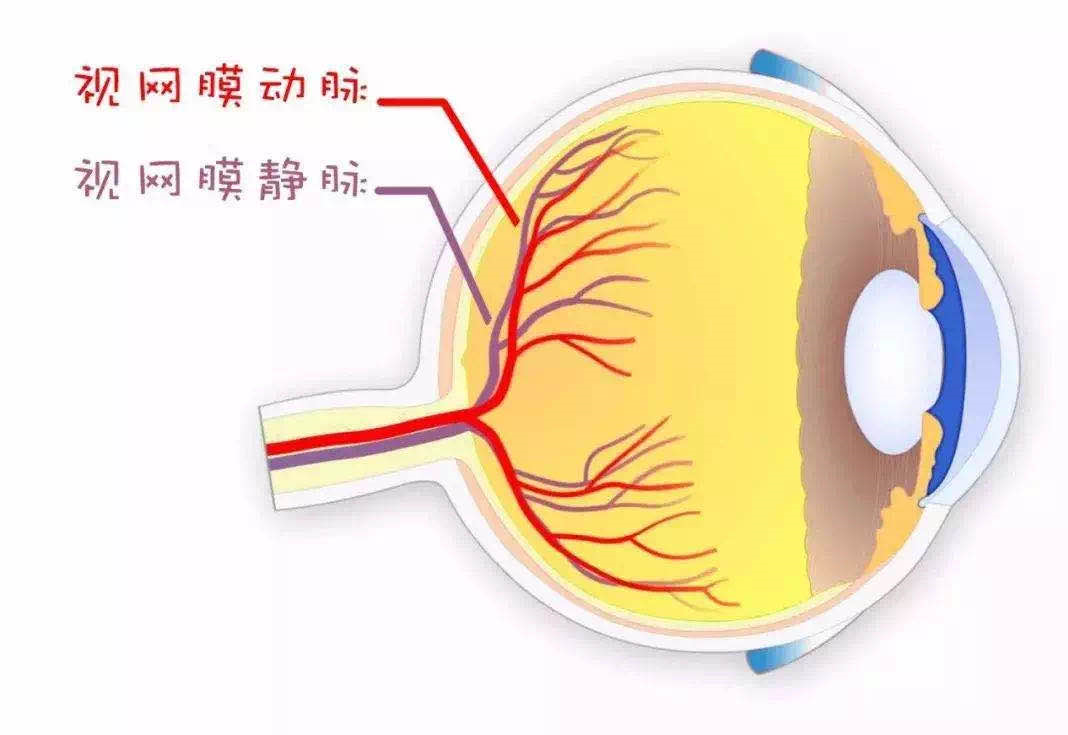 什么！眼睛也会中风？