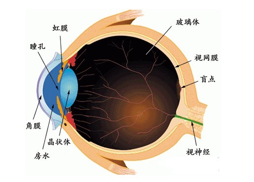 了解视网膜脱落